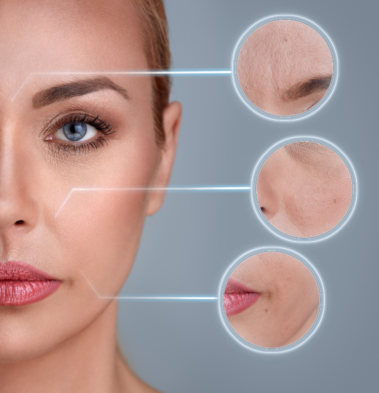 Skin Care Treatment in La Jolla, CA RevivaMed La Jolla