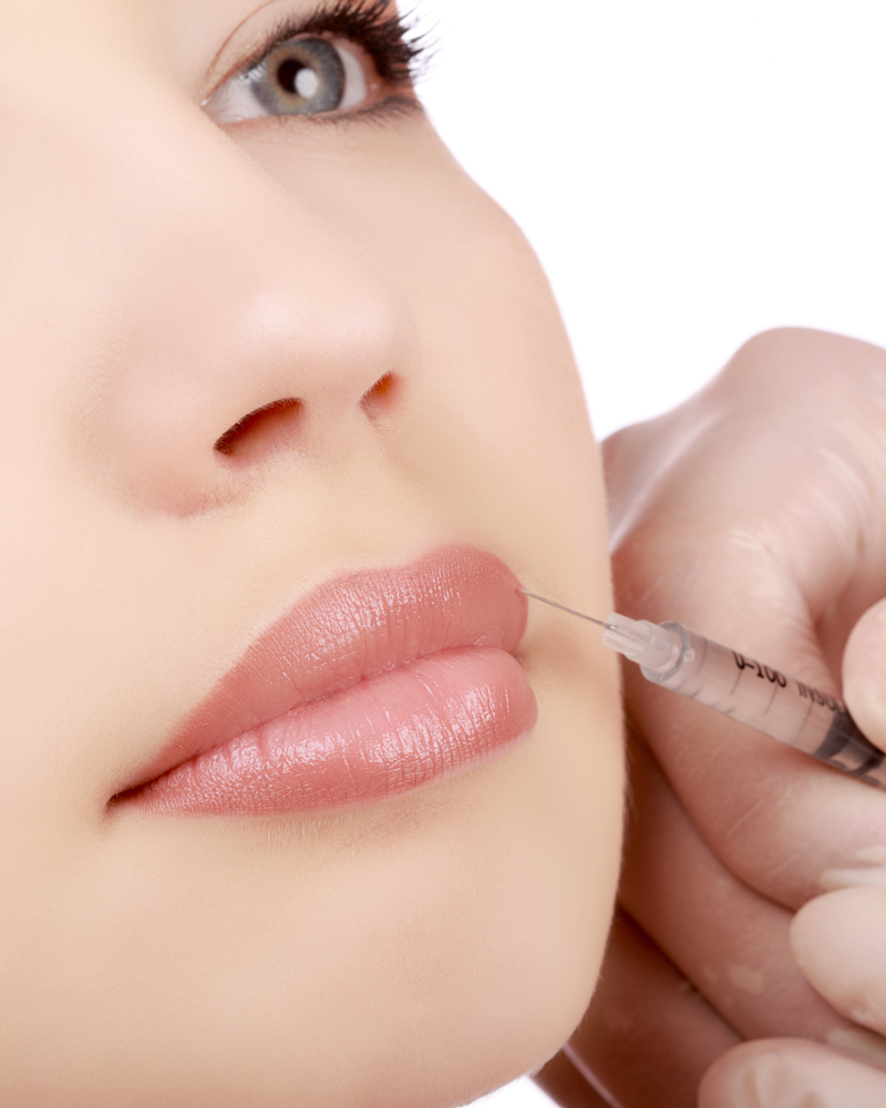 RevivaMed-Lip-Injections